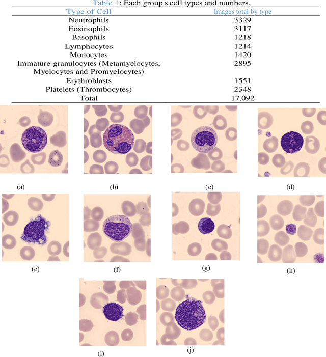 Figure 1 for Automatic Classification of Blood Cell Images Using Convolutional Neural Network