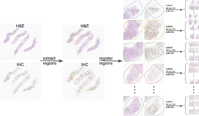 Figure 1 for Predicting Ki67, ER, PR, and HER2 Statuses from H&E-stained Breast Cancer Images