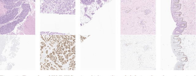 Figure 3 for Predicting Ki67, ER, PR, and HER2 Statuses from H&E-stained Breast Cancer Images