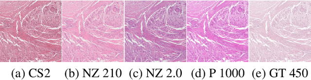 Figure 1 for Mind the Gap: Scanner-induced domain shifts pose challenges for representation learning in histopathology