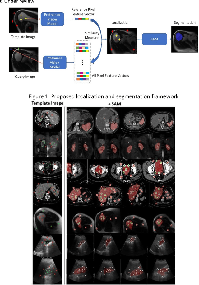 Figure 1 for One-shot Localization and Segmentation of Medical Images with Foundation Models
