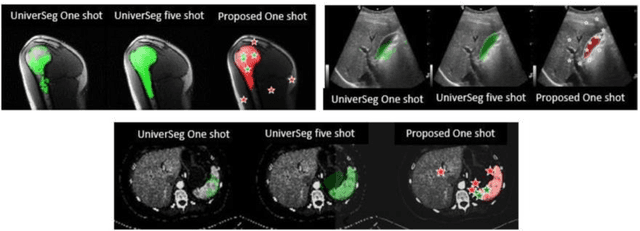 Figure 3 for One-shot Localization and Segmentation of Medical Images with Foundation Models