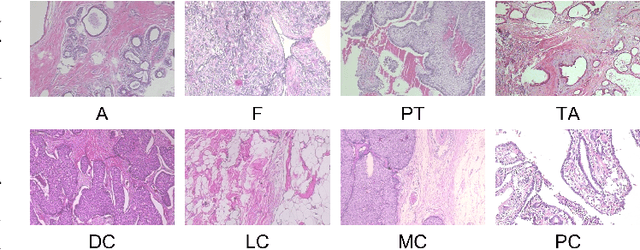 Figure 1 for ViT-DeiT: An Ensemble Model for Breast Cancer Histopathological Images Classification