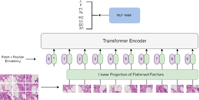 Figure 4 for ViT-DeiT: An Ensemble Model for Breast Cancer Histopathological Images Classification
