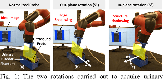 Figure 1 for RUSOpt: Robotic UltraSound Probe Normalization with Bayesian Optimization for In-plane and Out-plane Scanning
