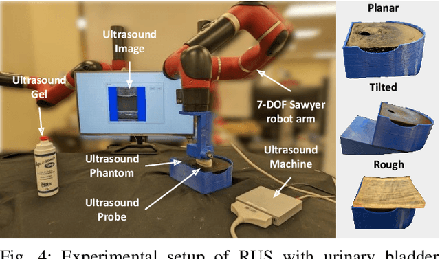 Figure 4 for RUSOpt: Robotic UltraSound Probe Normalization with Bayesian Optimization for In-plane and Out-plane Scanning