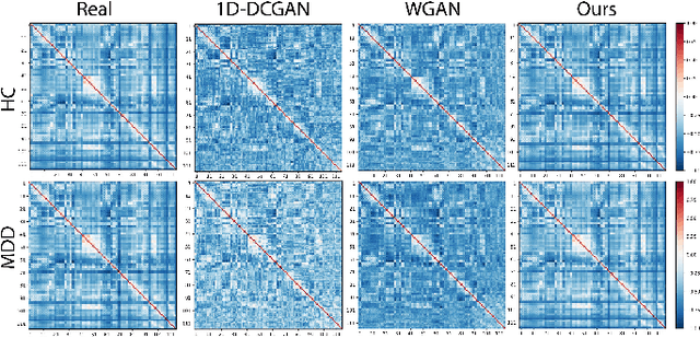 Figure 4 for Graph-Regularized Manifold-Aware Conditional Wasserstein GAN for Brain Functional Connectivity Generation