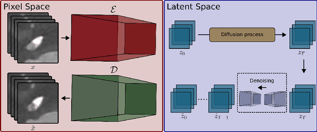 Figure 1 for Investigating Data Memorization in 3D Latent Diffusion Models for Medical Image Synthesis