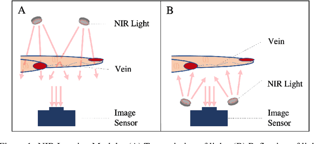 Figure 1 for Real-Time Superficial Vein Imaging System for Observing Abnormalities on Vascular Structures