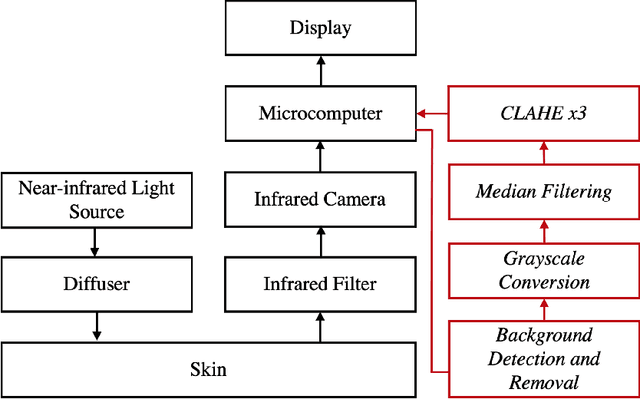 Figure 2 for Real-Time Superficial Vein Imaging System for Observing Abnormalities on Vascular Structures