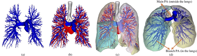 Figure 1 for Efficient automatic segmentation for multi-level pulmonary arteries: The PARSE challenge