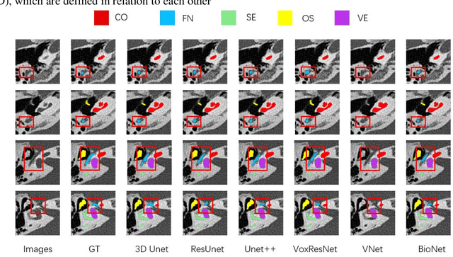 Figure 2 for WSC-Trans: A 3D network model for automatic multi-structural segmentation of temporal bone CT