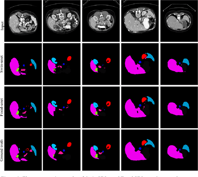 Figure 4 for Focal-UNet: UNet-like Focal Modulation for Medical Image Segmentation