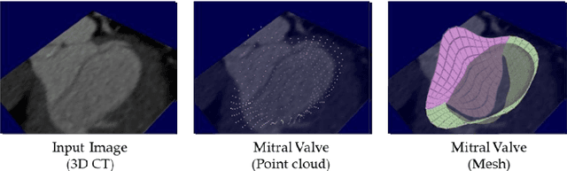 Figure 1 for Fully automatic mitral valve 4D shape extraction using probability maps