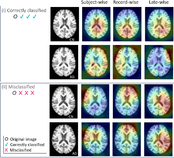 Figure 2 for How You Split Matters: Data Leakage and Subject Characteristics Studies in Longitudinal Brain MRI Analysis