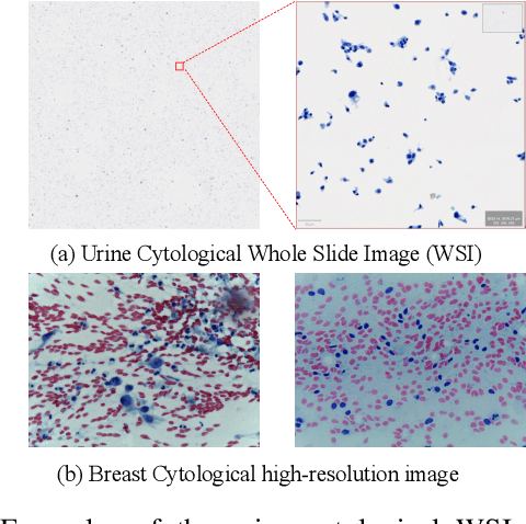 Figure 3 for Clinical-Inspired Cytological Whole Slide Image Screening with Just Slide-Level Labels