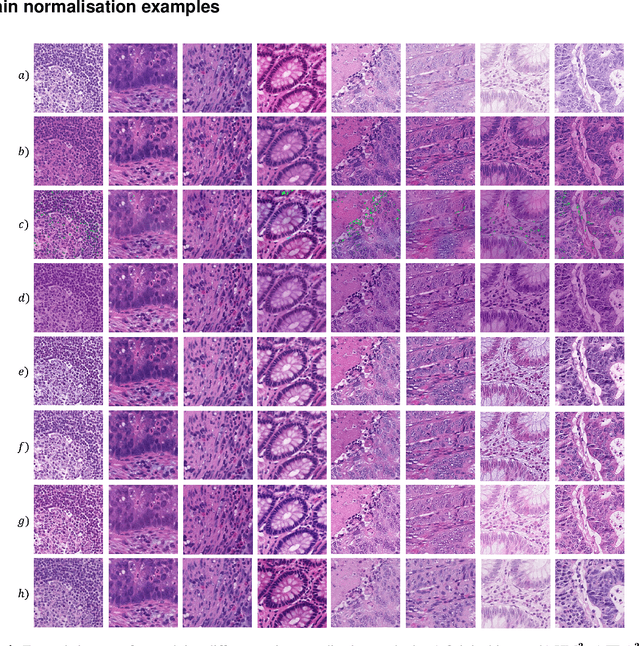 Figure 3 for Stain Consistency Learning: Handling Stain Variation for Automatic Digital Pathology Segmentation