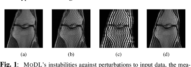 Figure 1 for SMUG: Towards robust MRI reconstruction by smoothed unrolling
