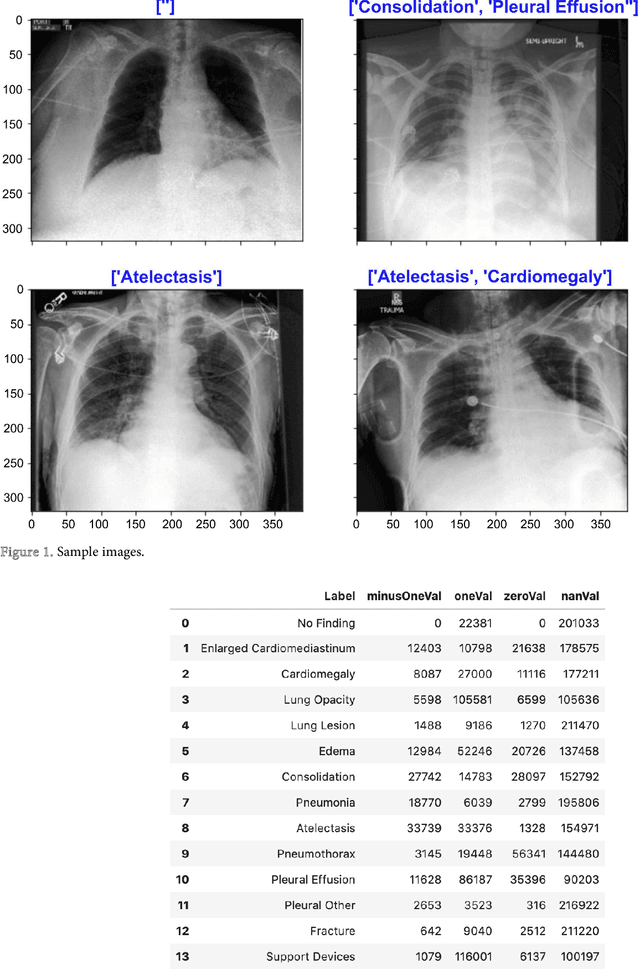 Figure 1 for Multi-Label Chest X-Ray Classification via Deep Learning