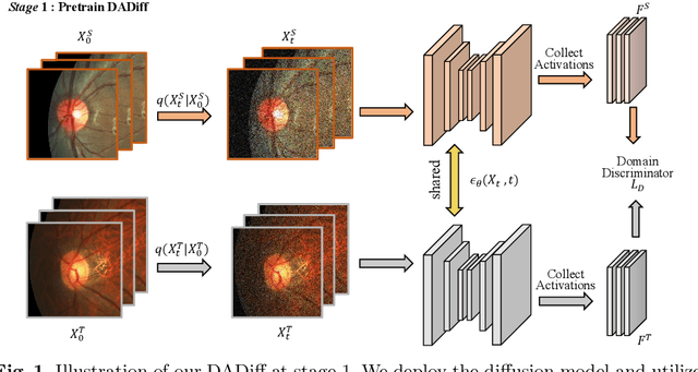 Figure 1 for Distribution Aligned Diffusion and Prototype-guided network for Unsupervised Domain Adaptive Segmentation