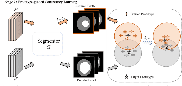 Figure 3 for Distribution Aligned Diffusion and Prototype-guided network for Unsupervised Domain Adaptive Segmentation