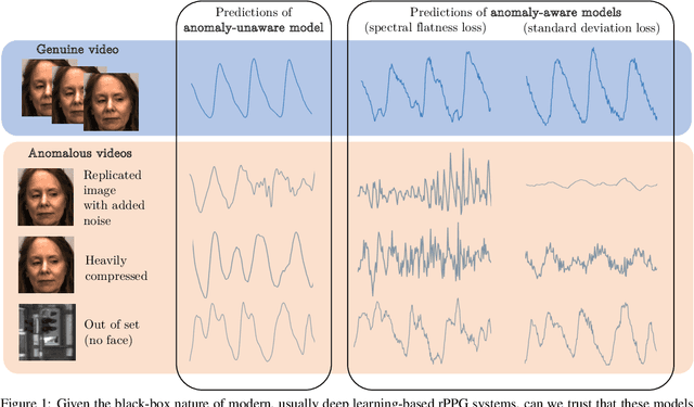 Figure 1 for Hallucinated Heartbeats: Anomaly-Aware Remote Pulse Estimation
