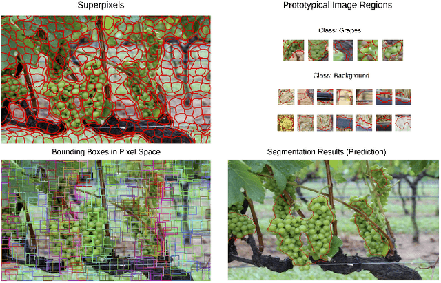 Figure 3 for A differentiable Gaussian Prototype Layer for explainable Segmentation