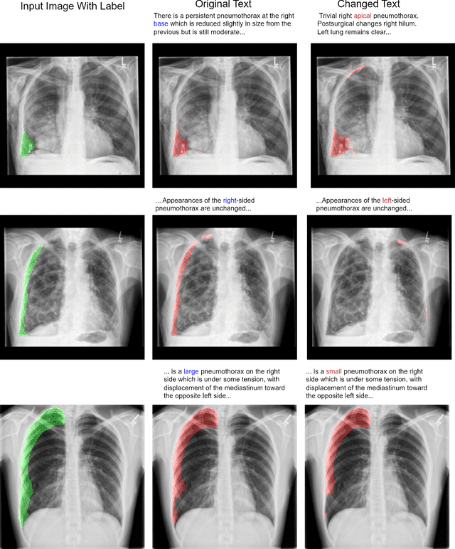 Figure 3 for ConTEXTual Net: A Multimodal Vision-Language Model for Segmentation of Pneumothorax