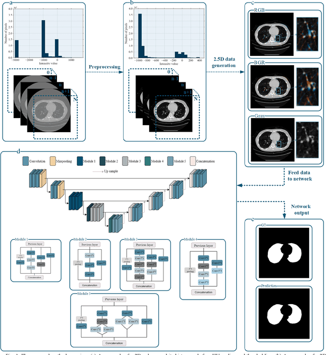 Figure 1 for Lung-Net: A deep learning framework for lung tissue segmentation in three-dimensional thoracic CT images