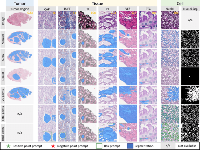 Figure 1 for Segment Anything Model (SAM) for Digital Pathology: Assess Zero-shot Segmentation on Whole Slide Imaging