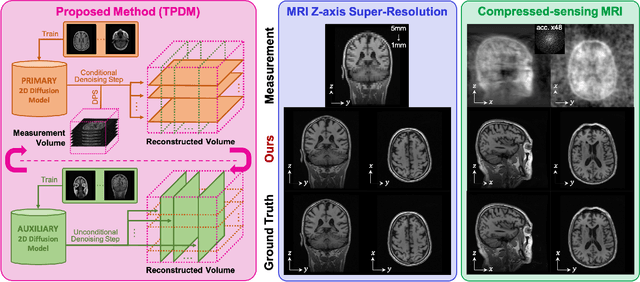 Figure 1 for Improving 3D Imaging with Pre-Trained Perpendicular 2D Diffusion Models