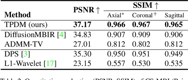 Figure 4 for Improving 3D Imaging with Pre-Trained Perpendicular 2D Diffusion Models