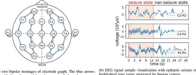 Figure 1 for Protecting the Future: Neonatal Seizure Detection with Spatial-Temporal Modeling