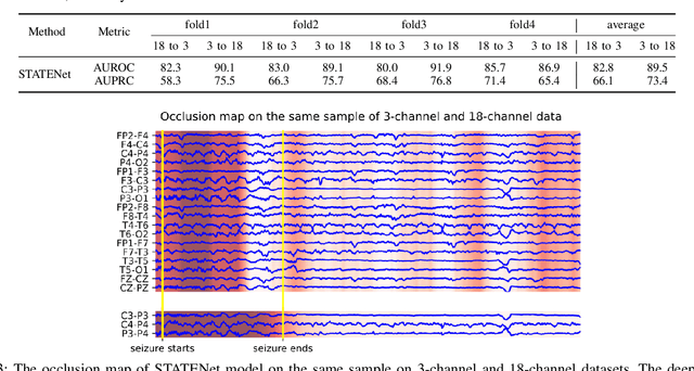 Figure 3 for Protecting the Future: Neonatal Seizure Detection with Spatial-Temporal Modeling