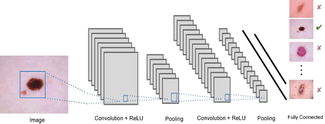 Figure 2 for Modified Topological Image Preprocessing for Skin Lesion Classifications