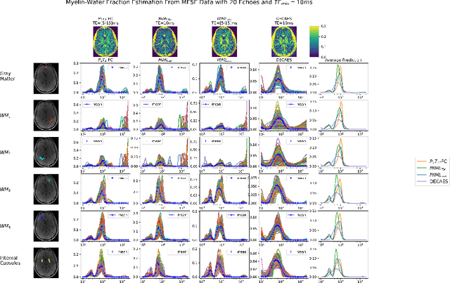 Figure 1 for P2T2: a Physically-primed deep-neural-network approach for robust $T_{2}$ distribution estimation from quantitative $T_{2}$-weighted MRI