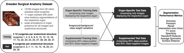 Figure 1 for Strategies to Improve Real-World Applicability of Laparoscopic Anatomy Segmentation Models
