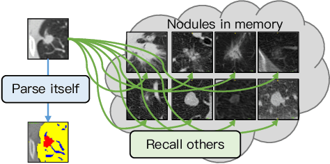 Figure 1 for Parse and Recall: Towards Accurate Lung Nodule Malignancy Prediction like Radiologists