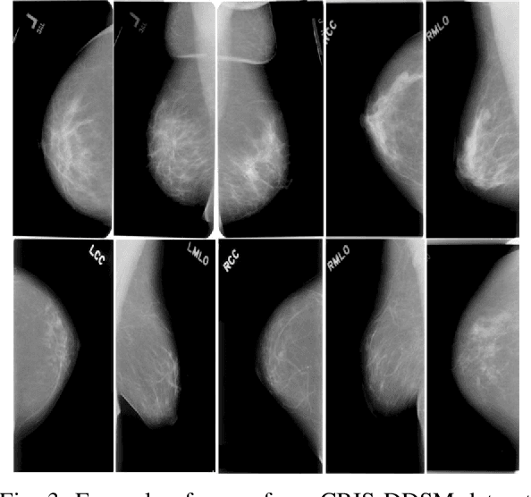 Figure 3 for IP-UNet: Intensity Projection UNet Architecture for 3D Medical Volume Segmentation