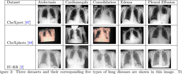 Figure 2 for Cross Modal Global Local Representation Learning from Radiology Reports and X-Ray Chest Images