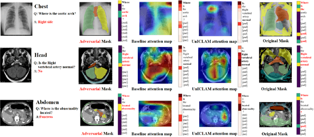 Figure 3 for UnICLAM:Contrastive Representation Learning with Adversarial Masking for Unified and Interpretable Medical Vision Question Answering