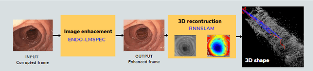 Figure 3 for Deep learning-based image exposure enhancement as a pre-processing for an accurate 3D colon surface reconstruction