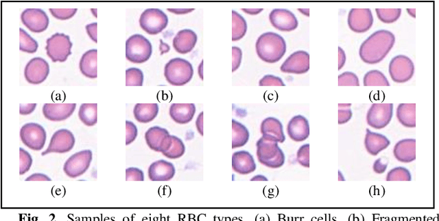 Figure 3 for Deep Learning Segmentation and Classification of Red Blood Cells Using a Large Multi-Scanner Dataset