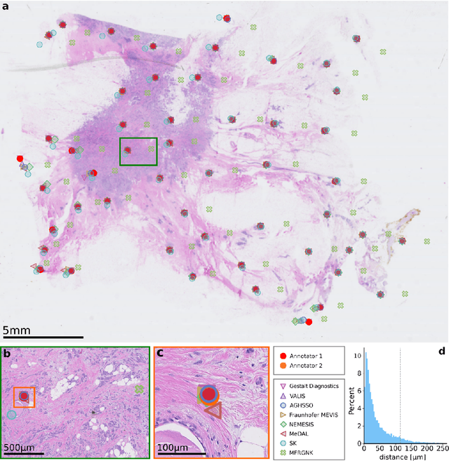 Figure 3 for The ACROBAT 2022 Challenge: Automatic Registration Of Breast Cancer Tissue