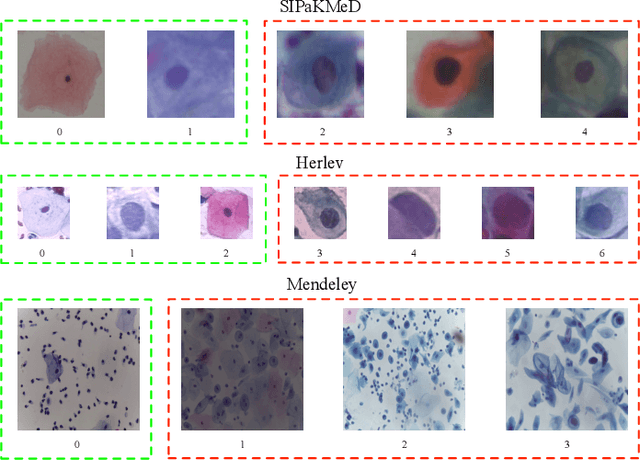 Figure 4 for A Voting-Stacking Ensemble of Inception Networks for Cervical Cytology Classification