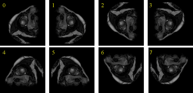 Figure 1 for Orientation recognition and correction of Cardiac MRI with deep neural network