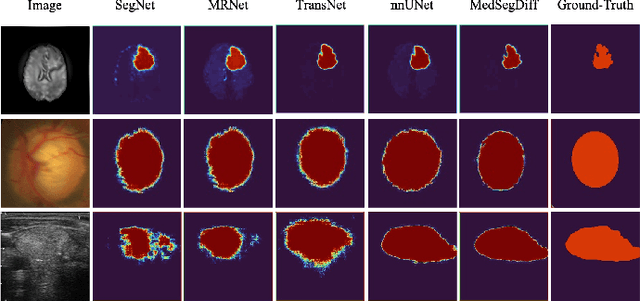 Figure 3 for MedSegDiff: Medical Image Segmentation with Diffusion Probabilistic Model