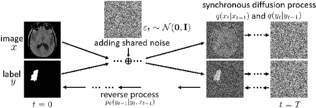 Figure 1 for Synchronous Image-Label Diffusion Probability Model with Application to Stroke Lesion Segmentation on Non-contrast CT