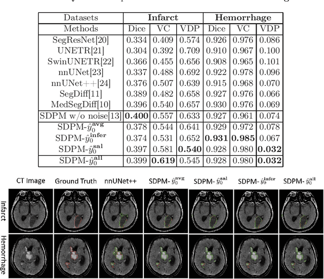 Figure 2 for Synchronous Image-Label Diffusion Probability Model with Application to Stroke Lesion Segmentation on Non-contrast CT