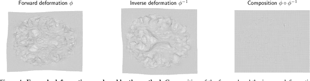 Figure 1 for ASymReg: Robust symmetric image registration using anti-symmetric formulation and deformation inversion layers